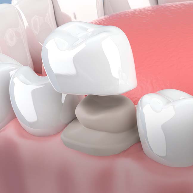 Treatment - Kings Avenue